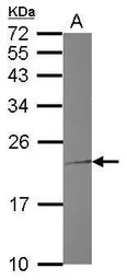 Anti-TNNI1 antibody [N1C3] used in Western Blot (WB). GTX114848
