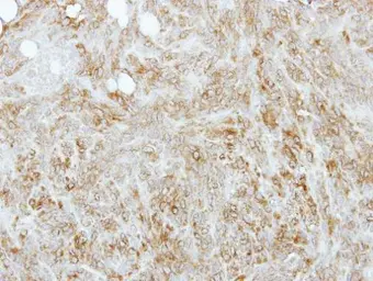 Anti-Tropomyosin 4 antibody used in IHC (Paraffin sections) (IHC-P). GTX114851
