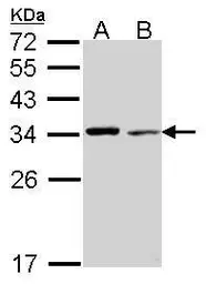 Anti-Tropomyosin 4 antibody used in Western Blot (WB). GTX114851