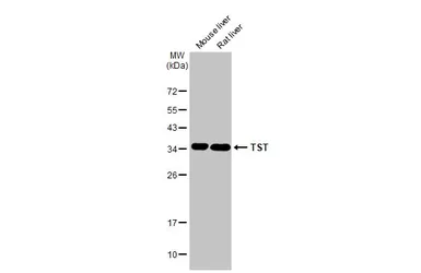 Anti-TST antibody used in Western Blot (WB). GTX114858