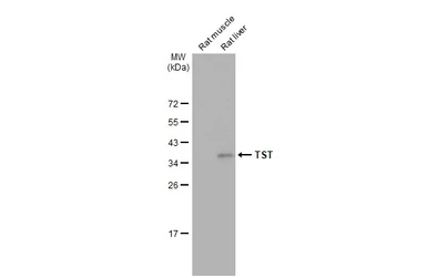 Anti-TST antibody used in Western Blot (WB). GTX114858