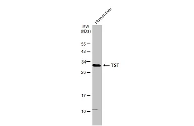 Anti-TST antibody used in Western Blot (WB). GTX114858