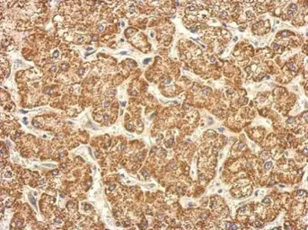 Anti-TST antibody used in IHC (Paraffin sections) (IHC-P). GTX114858