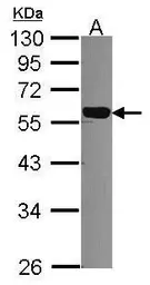 Anti-DNAJC7 antibody used in Western Blot (WB). GTX114860