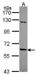 Anti-TULP2 antibody [C1C3] used in Western Blot (WB). GTX114865