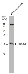 Anti-UBE2L3 antibody [N1C3] used in Western Blot (WB). GTX114870
