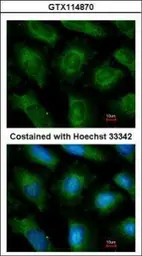 Anti-UBE2L3 antibody [N1C3] used in Immunocytochemistry/ Immunofluorescence (ICC/IF). GTX114870