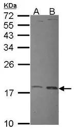 Anti-UBE2L3 antibody [N1C3] used in Western Blot (WB). GTX114870