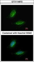 Anti-UMPS antibody used in Immunocytochemistry/ Immunofluorescence (ICC/IF). GTX114872