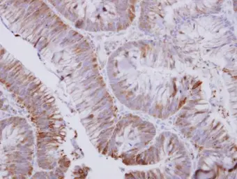 Anti-UMPS antibody used in IHC (Paraffin sections) (IHC-P). GTX114872