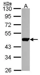 Anti-UMPS antibody used in Western Blot (WB). GTX114872