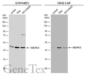 Anti-UQCRC2 antibody used in Western Blot (WB). GTX114873