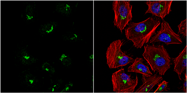 Anti-PFDN3 antibody used in Immunocytochemistry/ Immunofluorescence (ICC/IF). GTX114875