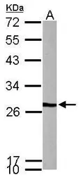 Anti-PFDN3 antibody used in Western Blot (WB). GTX114875