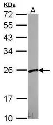 Anti-PFDN3 antibody used in Western Blot (WB). GTX114875