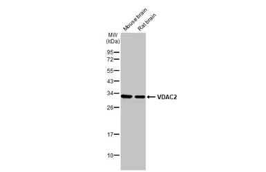 Anti-VDAC2 antibody [N1C2] used in Western Blot (WB). GTX114876