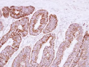 Anti-VDAC2 antibody [N1C2] used in IHC (Paraffin sections) (IHC-P). GTX114876