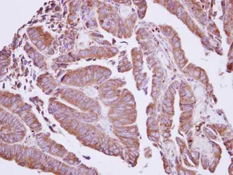 Anti-Coronin 2A antibody used in IHC (Paraffin sections) (IHC-P). GTX114879