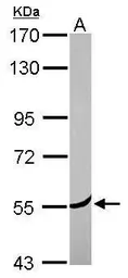 Anti-Coronin 2A antibody used in Western Blot (WB). GTX114879