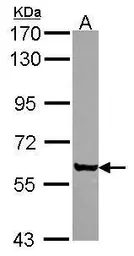 Anti-Coronin 2A antibody [C1C3] used in Western Blot (WB). GTX114880