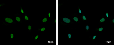 Anti-ZNF74 antibody [C1C3] used in Immunocytochemistry/ Immunofluorescence (ICC/IF). GTX114892