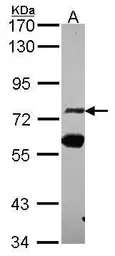 Anti-ZNF74 antibody [C1C3] used in Western Blot (WB). GTX114892