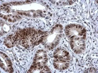 Anti-ZNF133 antibody [N1C1-2] used in IHC (Paraffin sections) (IHC-P). GTX114896
