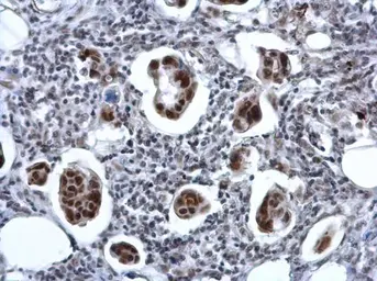 Anti-ZNF133 antibody [N1C1-2] used in IHC (Paraffin sections) (IHC-P). GTX114896