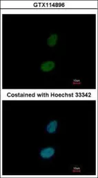 Anti-ZNF133 antibody [N1C1-2] used in Immunocytochemistry/ Immunofluorescence (ICC/IF). GTX114896