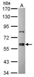 Anti-ZNF133 antibody [N1C1-2] used in Western Blot (WB). GTX114896