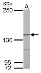 Anti-Nardilysin antibody [C2C3], C-term used in Western Blot (WB). GTX114899