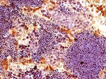 Anti-EIF4A1 antibody [N2C2], Internal used in IHC (Paraffin sections) (IHC-P). GTX114910