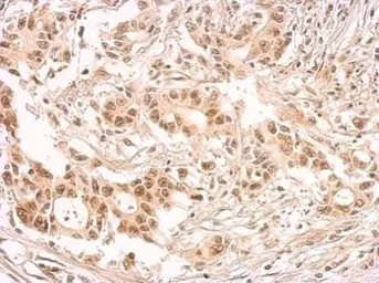 Anti-SF2 antibody used in IHC (Paraffin sections) (IHC-P). GTX114918
