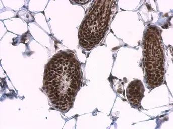 Anti-SF2 antibody used in IHC (Paraffin sections) (IHC-P). GTX114918