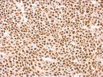 Anti-SF2 antibody used in IHC (Paraffin sections) (IHC-P). GTX114918
