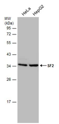 Anti-SF2 antibody used in Western Blot (WB). GTX114918