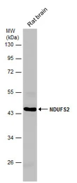 Anti-NDUFS2 antibody used in Western Blot (WB). GTX114924