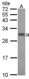 Anti-SNRPN antibody used in Western Blot (WB). GTX114927