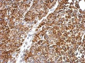 Anti-DPH2 antibody used in IHC (Paraffin sections) (IHC-P). GTX114929
