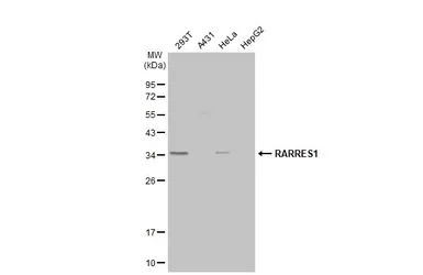 Anti-RARRES1 antibody [N2C3] used in Western Blot (WB). GTX114937