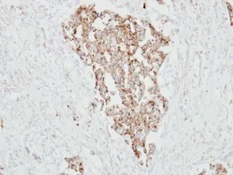 Anti-RARRES1 antibody [N2C3] used in IHC (Paraffin sections) (IHC-P). GTX114937