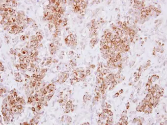 Anti-HLA-DMA antibody used in IHC (Paraffin sections) (IHC-P). GTX114939