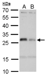 Anti-HLA-DMA antibody used in Western Blot (WB). GTX114939