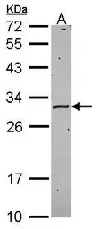 Anti-HLA-DMA antibody used in Western Blot (WB). GTX114939