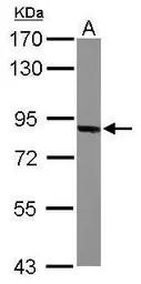 Anti-Thimet Oligopeptidase antibody [C1C3] used in Western Blot (WB). GTX114946