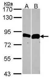 Anti-Thimet Oligopeptidase antibody [C1C3] used in Western Blot (WB). GTX114946