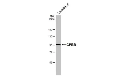 Anti-GPBB antibody [N1N2], N-term used in Western Blot (WB). GTX114952