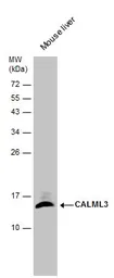 Anti-CALML3 antibody [N1C3] used in Western Blot (WB). GTX114954