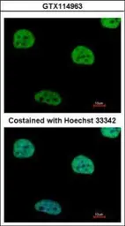 Anti-RIP / Rab antibody used in Immunocytochemistry/ Immunofluorescence (ICC/IF). GTX114963