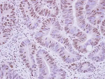 Anti-RIP / Rab antibody used in IHC (Paraffin sections) (IHC-P). GTX114963
